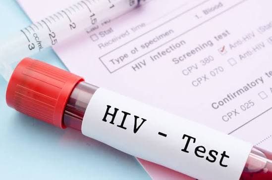 HIV மற்றும் பாலியல் நோய்களைத் தடுக்க ஆணுறையை பயன்படுத்துங்கள்
